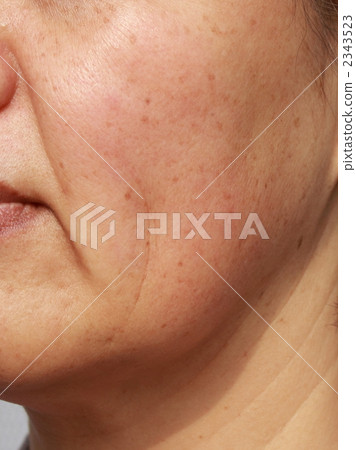 暗沉斑點 2343523