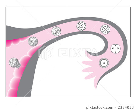 植入 植入 2354033