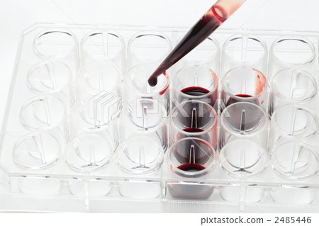Blood test Blood test 2485446