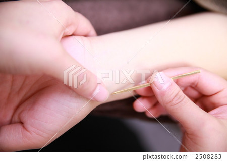 acupuncture acupuncture 2508283