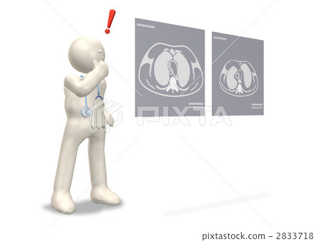 顯示病變發現的3DCG例證 2833718