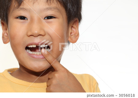 牙齒變化 3056018