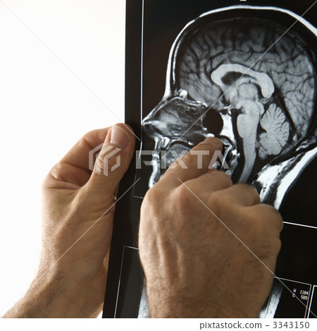 Man holding x ray. Man holding x ray. 3343150