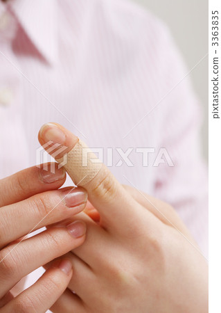 Injuries to the fingers 3363835