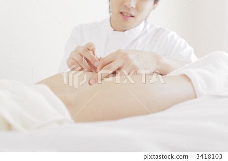 針灸師 針灸 東方醫學 3418103