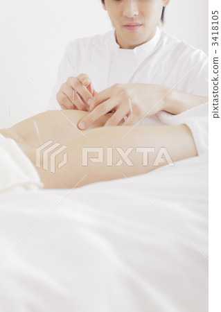 針灸師 針灸 東方醫學 3418105