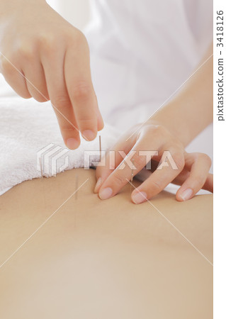 針灸師 針灸 東方醫學 3418126