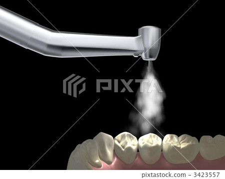 Dental treatment 3423557