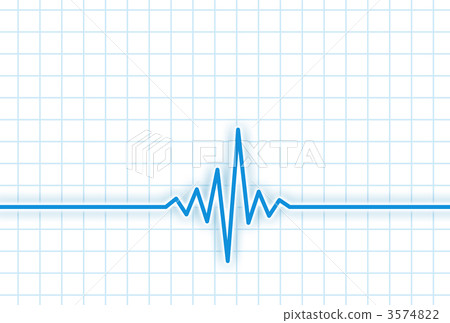心電圖 瓦楞 醫療和醫學 3574822
