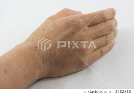 粗糙的手 3582818