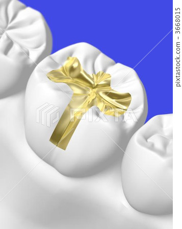 Dental treatment 3668015