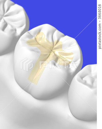 Dental treatment Dental treatment 3668016
