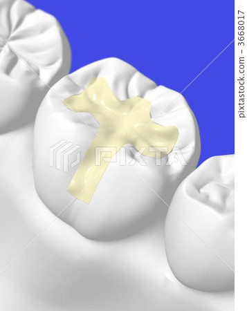 Dental treatment Dental treatment 3668017