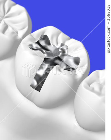 牙科治療 牙科治療 3668018