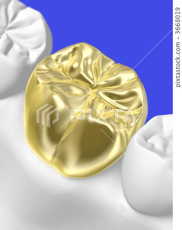 牙科治療 牙科治療 3668019