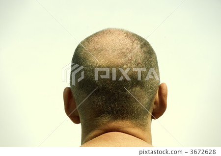 baldness baldness 3672628