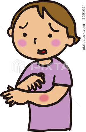 Insect bites Insect bites 3691634