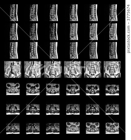 MRI image MRI image 3775674