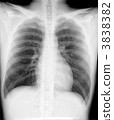 X-ray chest 3838382