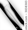 Roentgen right knee joint and shin 3838383