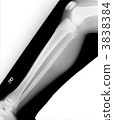 Roentgen right knee joint and shin 3838384
