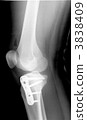 Roentgen right knee joint and shin medical device · With bolt 3838409