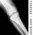 Roentgen right knee joint and shin medical device · With bolt 3838421
