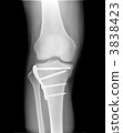 Roentgen right knee joint and shin medical device · With bolt 3838423