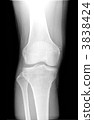 Roentgen right knee joint and shin 3838424