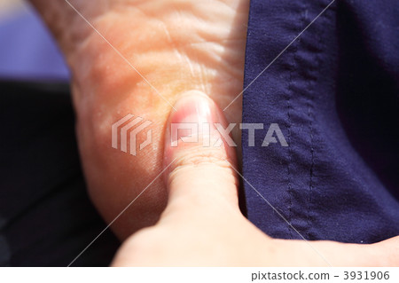 Deep tissue massage to the heel of the foot 3931906