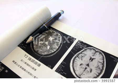 MRI image MRI image 3991587