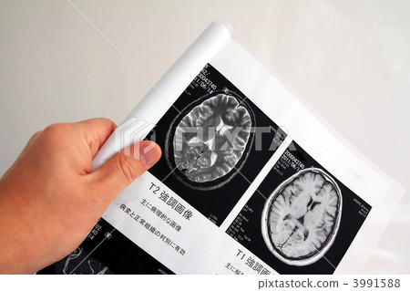 Brain Dock Test Results Brain Dock Test Results 3991588