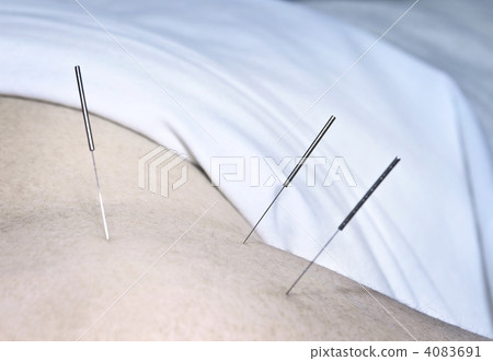 Acupuncture needles in shoulder Acupuncture needles in shoulder 4083691