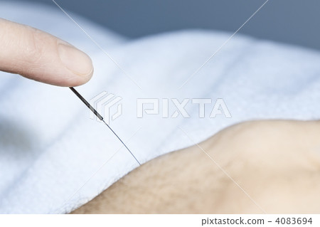 Acupuncture needle in skin Acupuncture needle in skin 4083694