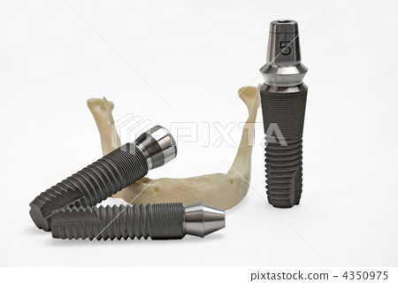 Models of dental titanium implants and plastic human jaw Models of dental titanium implants and plastic human jaw 4350975