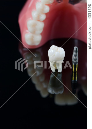 Real Human Wisdom tooth, Dental Implant and Plastic Teeth Model 4351898
