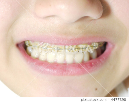 Orthodontics Orthodontics 4477890