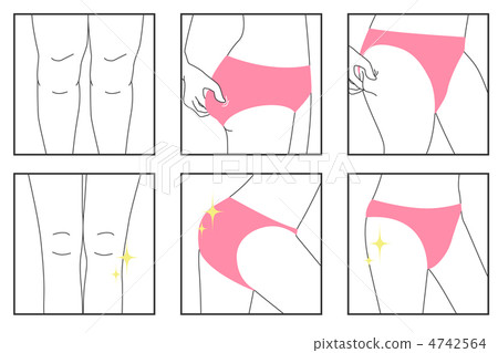 Esthetic lower body A-10 4742564