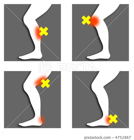 Leg Injury A-3 Leg Injury A-3 4752867