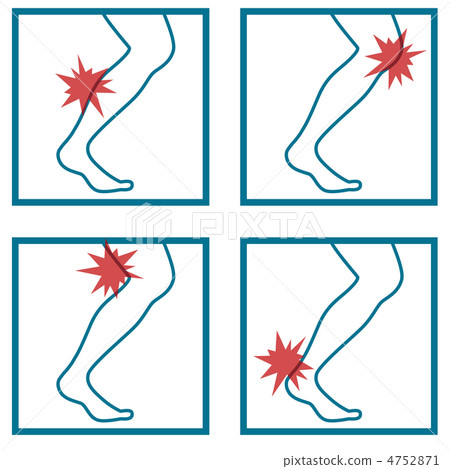 Leg Injury B-2 Leg Injury B-2 4752871
