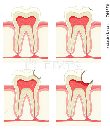 Tooth 4764776