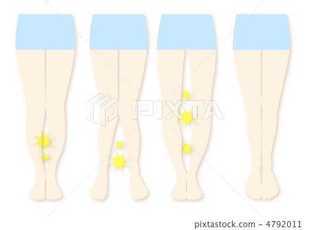 O leg 13 4792011