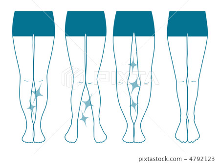 O leg -29 O leg -29 4792123