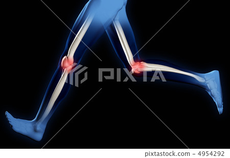 Pain in knee joints 4954292