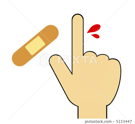 Finger injury 5153447