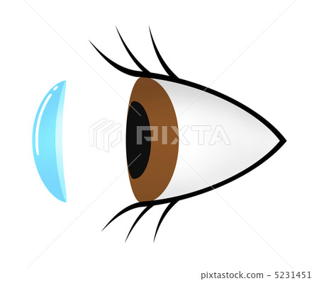 Attachment of contact lens Attachment of contact lens 5231451
