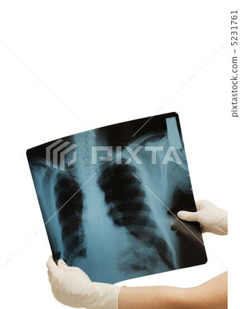 Two hands holding x-ray image of human body Two hands holding x-ray image of human body 5231761