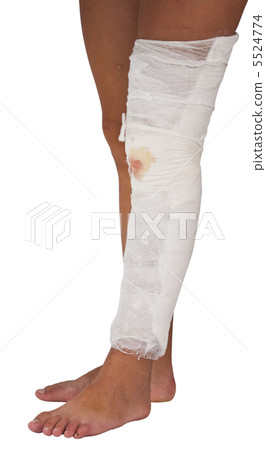 bandaged wound bandaged wound 5524774
