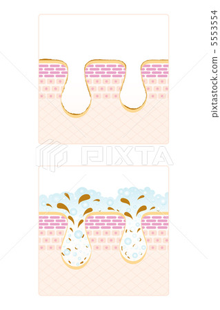 皮膚護理-11■毛孔·面部清潔·皮膚·皮膚·剖面圖·垂直 5553554