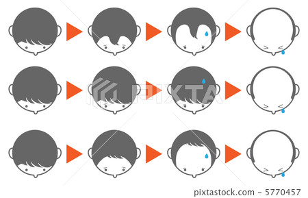 Hair loss -4 5770457